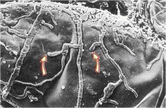 http://www.doctor-obregon.com/siteimages/paecilomyces1.jpg